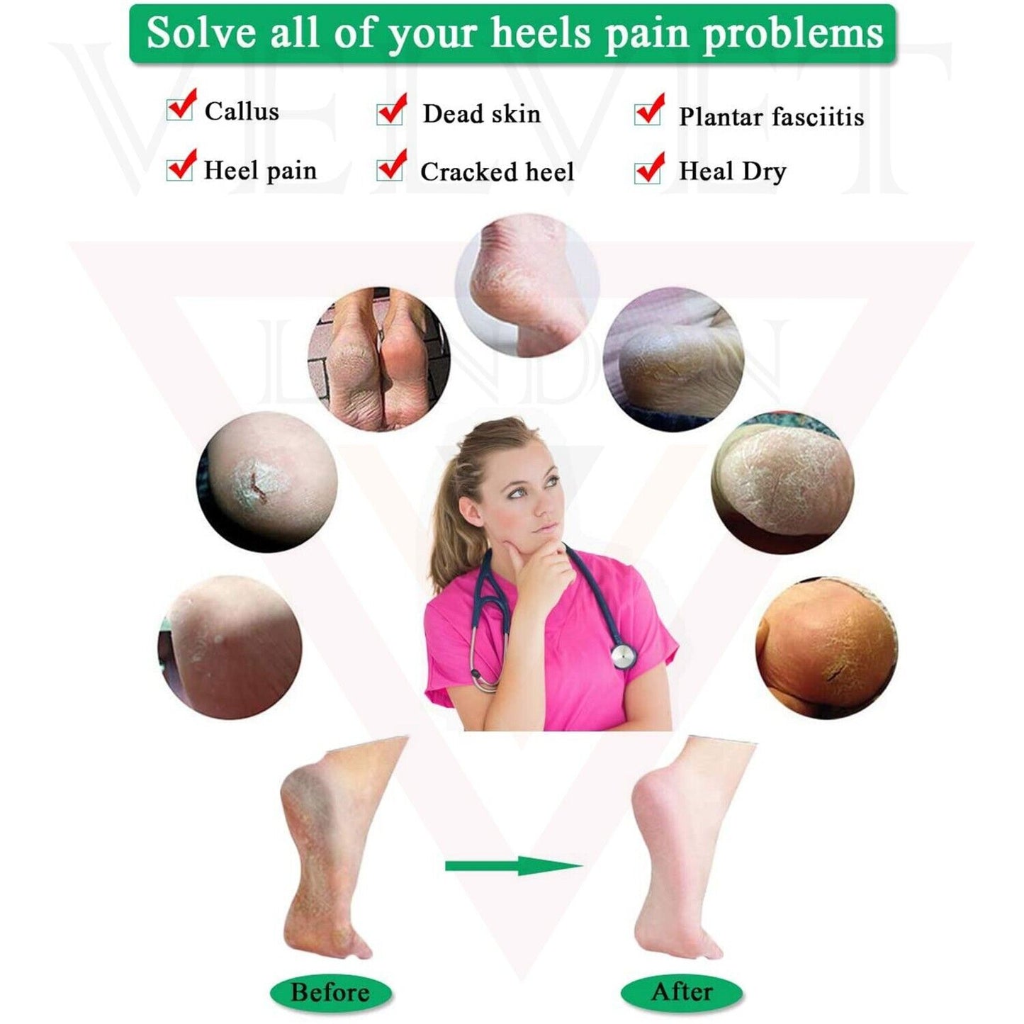 2x Gel Heel Protectors Silicone Heel Sleeves Ankle Protectors Cracked Foot Skin