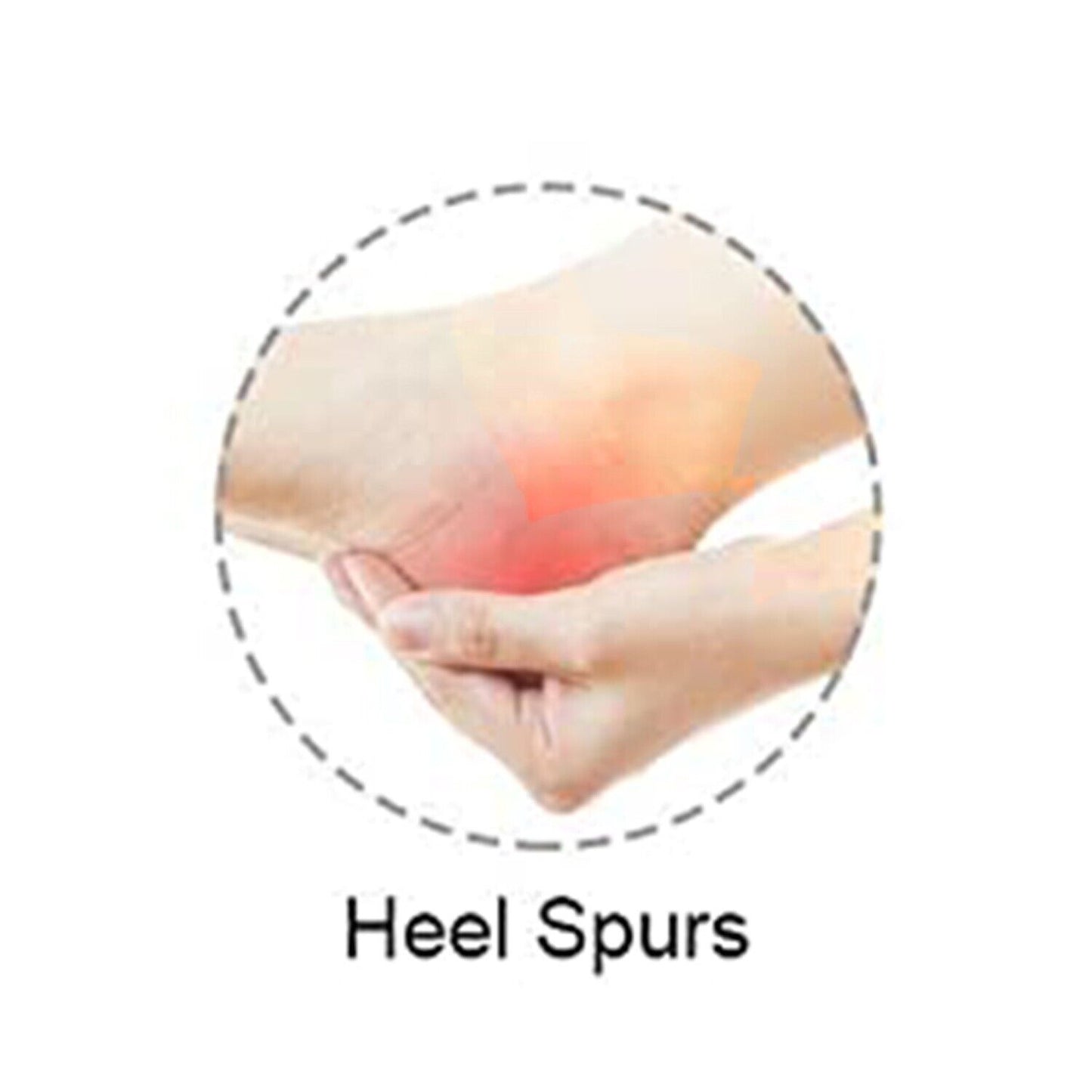 2x Gel Heel Protectors Silicone Heel Sleeves Ankle Protectors Cracked Foot Skin
